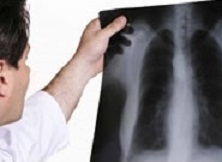 x-ray-diagnostics-miami